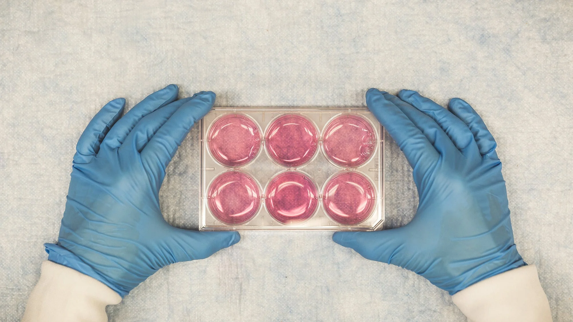 A close-up shot of the hands of a specialist reviewing the product in medical gloves